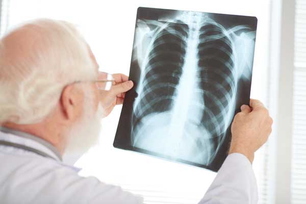 Chest X-Ray - Image by pressfoto on Freepik